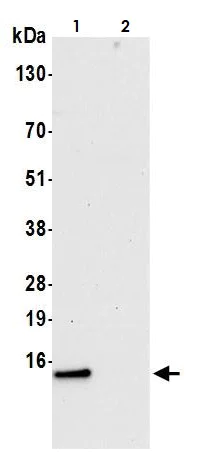 Immunoprecipitation - Anti-COX5B antibody (AB264401)
