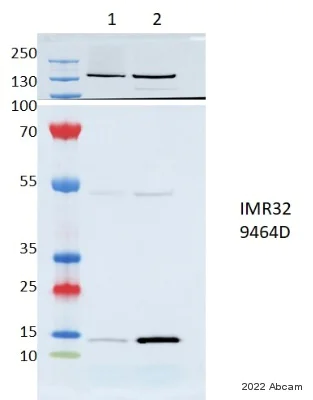 Western blot - Anti-COX5B antibody [EPR14439(B)] (AB180136)