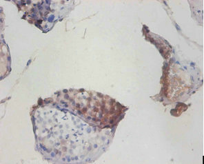 Immunohistochemistry (Formalin/PFA-fixed paraffin-embedded sections) - Anti-COX6A1 antibody (AB236889)