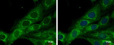 Immunocytochemistry/ Immunofluorescence - Anti-COX6A2 antibody (AB96096)