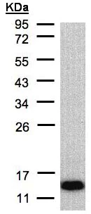 Western blot - Anti-COX6A2 antibody (AB96096)