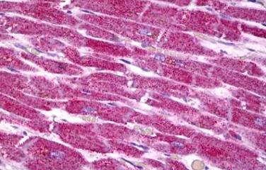 Immunohistochemistry (Formalin/PFA-fixed paraffin-embedded sections) - Anti-COX7A2 antibody (AB131143)