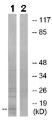 Western blot - Anti-COX7A2 antibody (AB131143)
