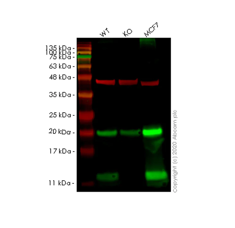 Western blot - Anti-COX7B antibody [EPR9326(B)] (AB140629)