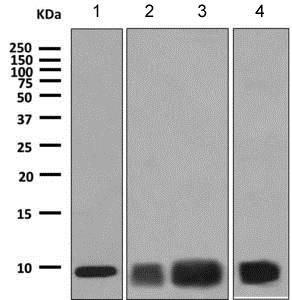 Western blot - Anti-COX7B antibody [EPR9326(B)] (AB140629), expandable thumbnail