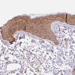 Immunohistochemistry (Formalin/PFA-fixed paraffin-embedded sections) - Anti-COX8A antibody (AB185449)
