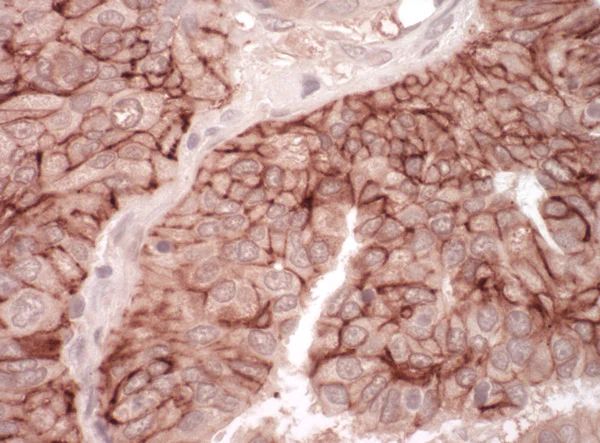 Immunohistochemistry (Formalin/PFA-fixed paraffin-embedded sections) - Anti-Coxsackie Adenovirus Receptor/hCAR antibody (AB100811)