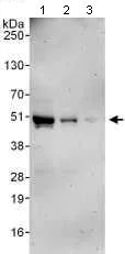 Western blot - Anti-Coxsackie Adenovirus Receptor/hCAR antibody (AB100811)