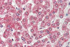 Immunohistochemistry (Formalin/PFA-fixed paraffin-embedded sections) - Anti-Coxsackie Adenovirus Receptor/hCAR antibody (AB133380)