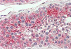 Immunohistochemistry (Formalin/PFA-fixed paraffin-embedded sections) - Anti-Coxsackie Adenovirus Receptor/hCAR antibody (AB133380)