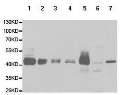 Western blot - Anti-Coxsackie Adenovirus Receptor/hCAR antibody (AB180761), expandable thumbnail