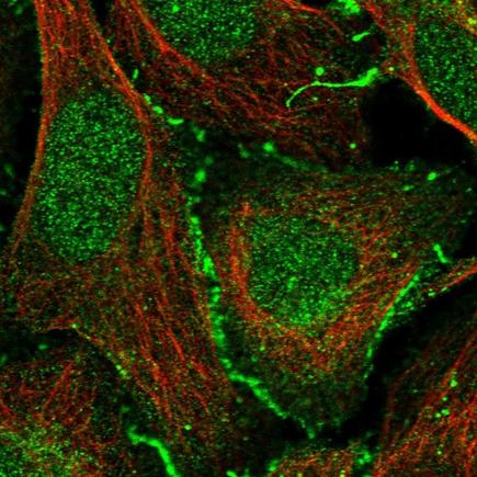 Immunocytochemistry/ Immunofluorescence - Anti-Coxsackie Adenovirus Receptor/hCAR antibody (AB223689)