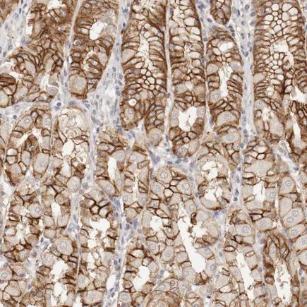 Immunohistochemistry (Formalin/PFA-fixed paraffin-embedded sections) - Anti-Coxsackie Adenovirus Receptor/hCAR antibody (AB223689)
