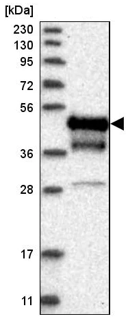 Western blot - Anti-Coxsackie Adenovirus Receptor/hCAR antibody (AB223689)