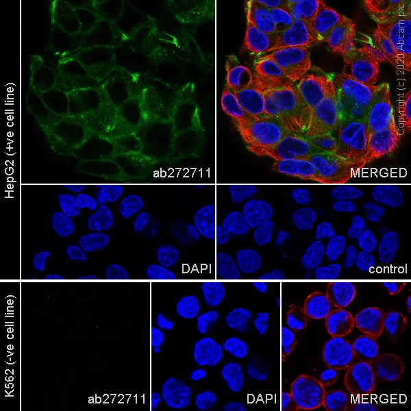 Immunocytochemistry/ Immunofluorescence - Anti-Coxsackie Adenovirus Receptor/hCAR antibody [EPR23305-44] (AB272711)