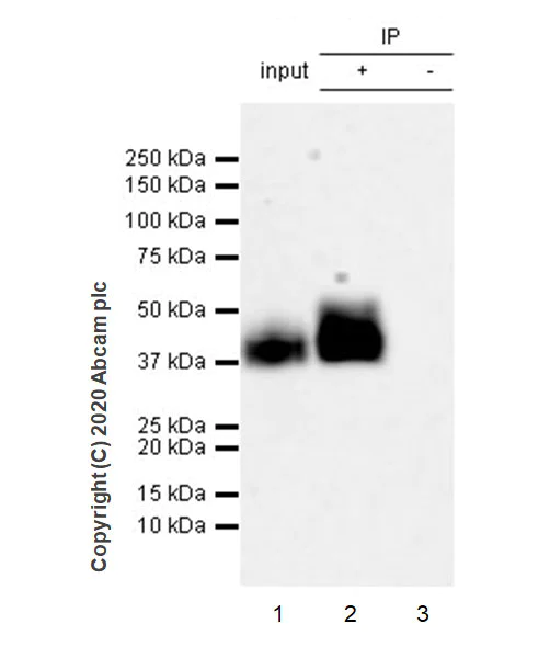 Immunoprecipitation - Anti-Coxsackie Adenovirus Receptor/hCAR antibody [EPR23305-44] (AB272711)