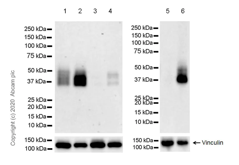 Western blot - Anti-Coxsackie Adenovirus Receptor/hCAR antibody [EPR23305-44] (AB272711)