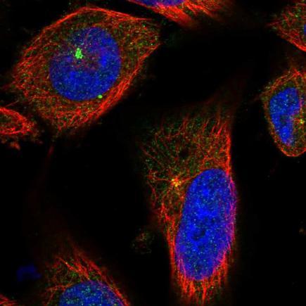 Immunocytochemistry/ Immunofluorescence - Anti-CP110 antibody (AB243696), expandable thumbnail
