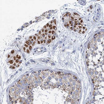Immunohistochemistry (Formalin/PFA-fixed paraffin-embedded sections) - Anti-CP110 antibody (AB243696)