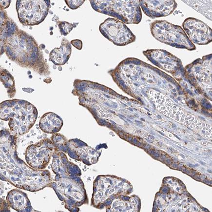 Immunohistochemistry (Formalin/PFA-fixed paraffin-embedded sections) - Anti-CP110 antibody (AB243696), expandable thumbnail