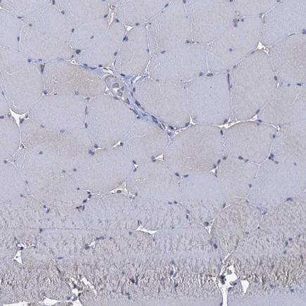 Immunohistochemistry (Formalin/PFA-fixed paraffin-embedded sections) - Anti-CP110 antibody (AB243696), expandable thumbnail