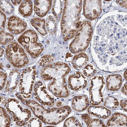 Immunohistochemistry (Formalin/PFA-fixed paraffin-embedded sections) - Anti-CP110 antibody (AB243696), expandable thumbnail