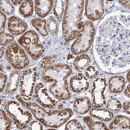 Immunohistochemistry (Formalin/PFA-fixed paraffin-embedded sections) - Anti-CP110 antibody (AB243696)