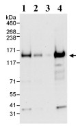 Western blot - Anti-CP110 antibody (AB99338)