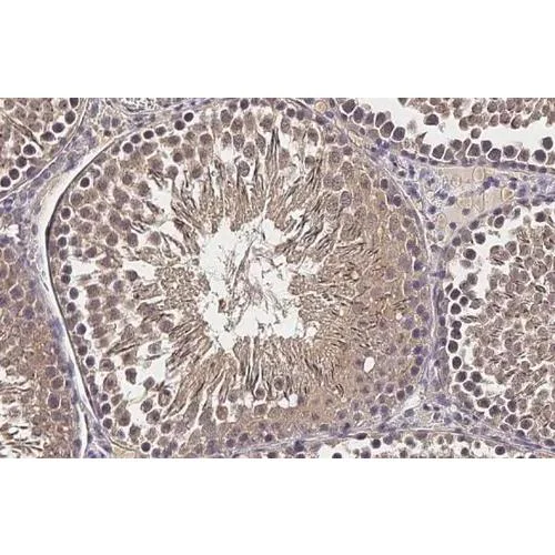 Immunohistochemistry (Formalin/PFA-fixed paraffin-embedded sections) - Anti-CP110 antibody [HL2312] (AB317196)