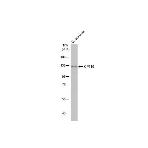 Western blot - Anti-CP110 antibody [HL2312] (AB317196)