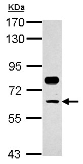 Western blot - Anti-CP2c antibody (AB155238), expandable thumbnail