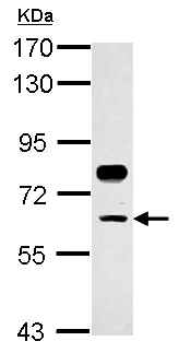 Western blot - Anti-CP2c antibody (AB155238)