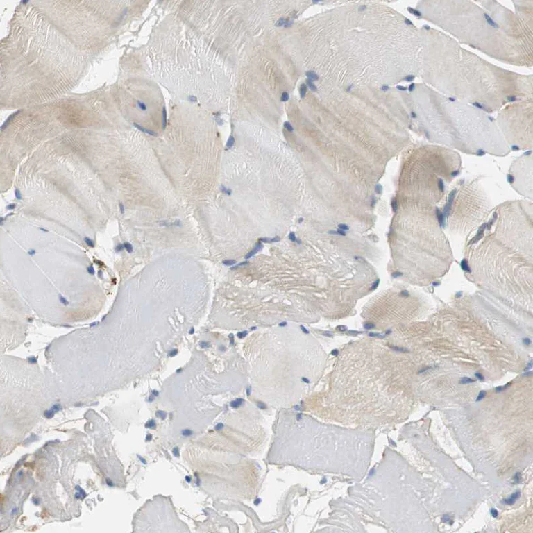 Immunohistochemistry (Formalin/PFA-fixed paraffin-embedded sections) - Anti-CPA3 antibody (AB251685)