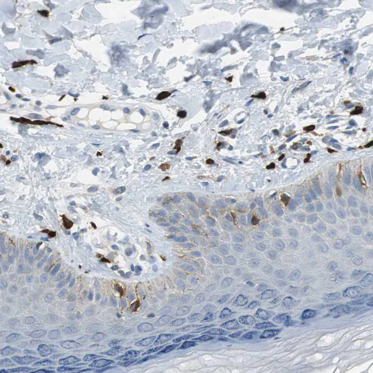Immunohistochemistry (Formalin/PFA-fixed paraffin-embedded sections) - Anti-CPA3 antibody (AB251685)