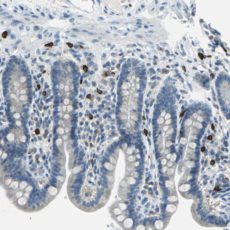 Immunohistochemistry (Formalin/PFA-fixed paraffin-embedded sections) - Anti-CPA3 antibody (AB251685)
