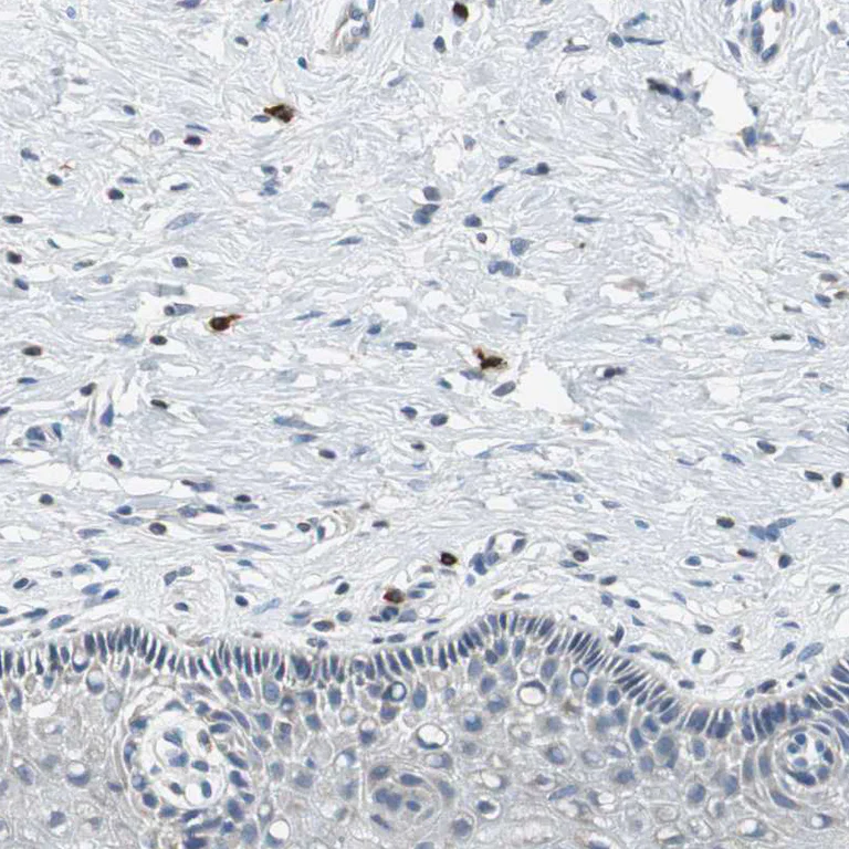 Immunohistochemistry (Formalin/PFA-fixed paraffin-embedded sections) - Anti-CPA3 antibody (AB251685)