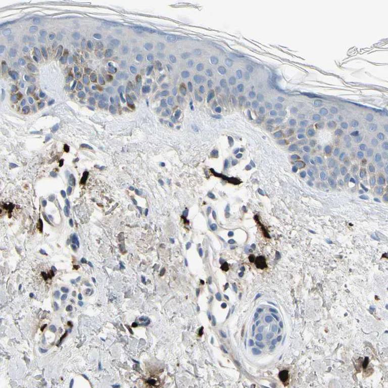 Immunohistochemistry (Formalin/PFA-fixed paraffin-embedded sections) - Anti-CPA3 antibody (AB251696)
