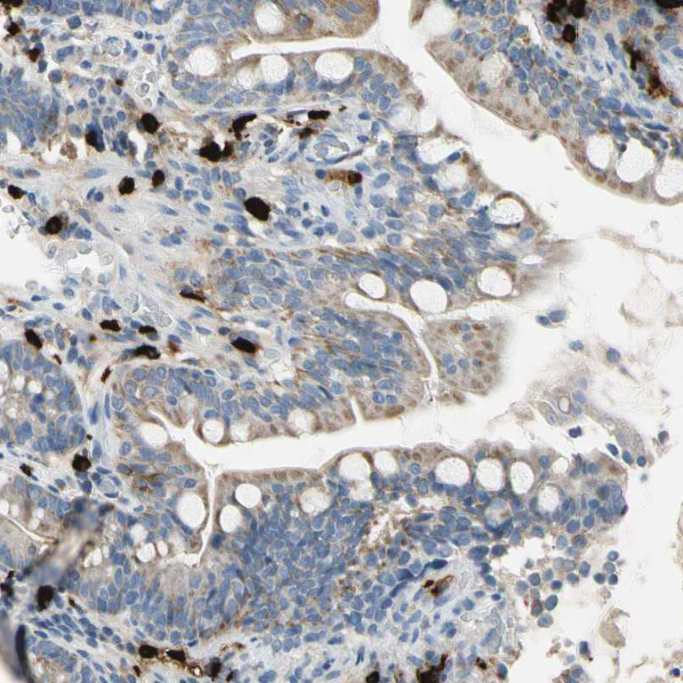 Immunohistochemistry (Formalin/PFA-fixed paraffin-embedded sections) - Anti-CPA3 antibody (AB251696)
