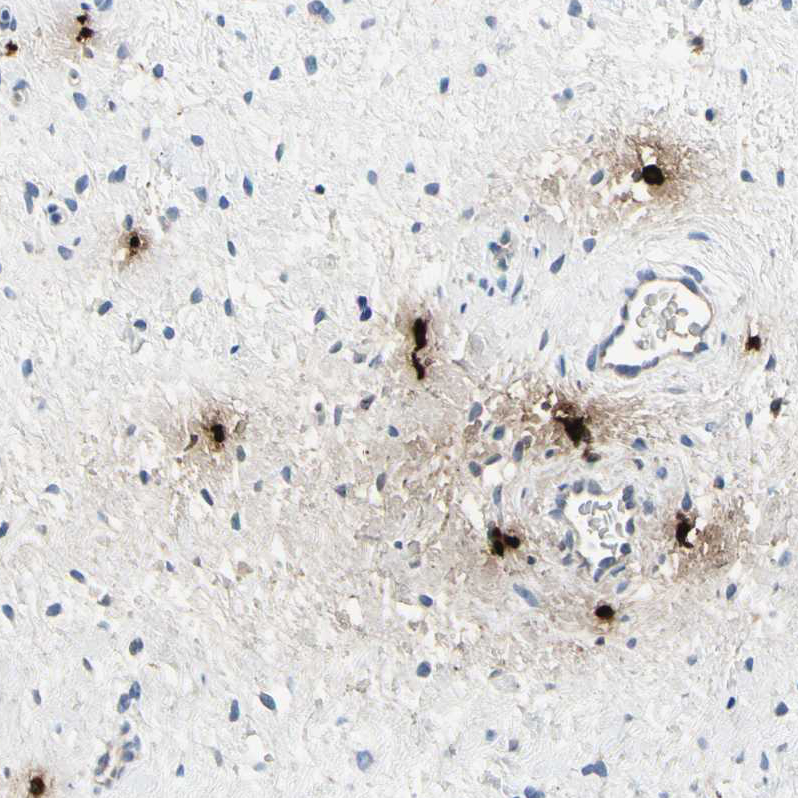 Immunohistochemistry (Formalin/PFA-fixed paraffin-embedded sections) - Anti-CPA3 antibody (AB251696)
