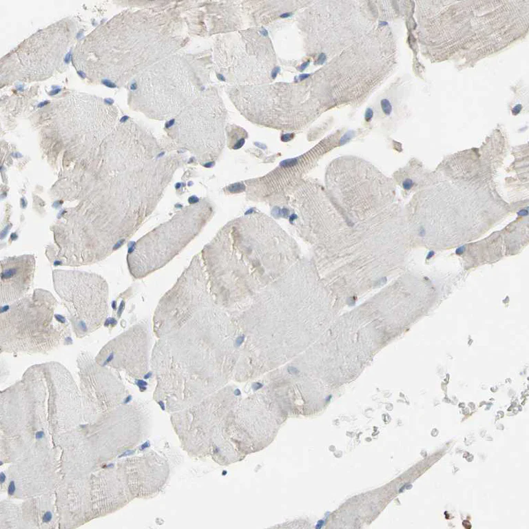 Immunohistochemistry (Formalin/PFA-fixed paraffin-embedded sections) - Anti-CPA3 antibody (AB251696)