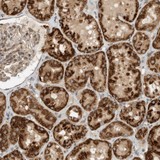 Immunohistochemistry (Formalin/PFA-fixed paraffin-embedded sections) - Anti-CPAMD8 antibody (AB122168), expandable thumbnail