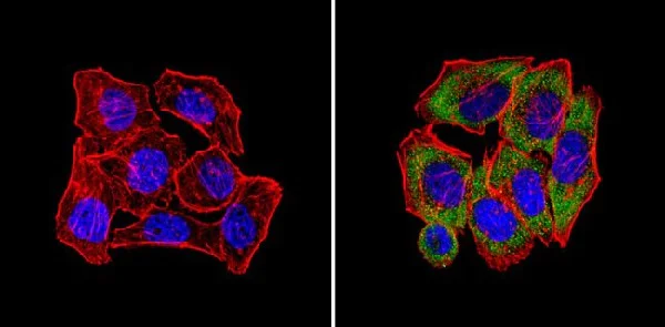 Immunocytochemistry/ Immunofluorescence - Anti-CPEB1 antibody (AB3465)