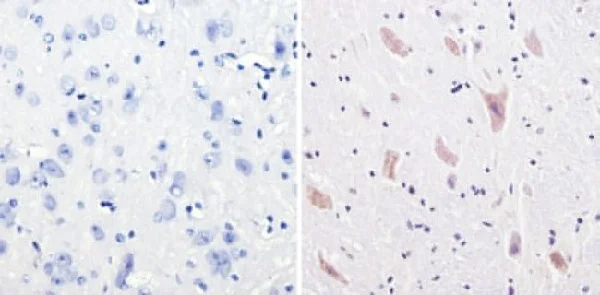 Immunohistochemistry (Formalin/PFA-fixed paraffin-embedded sections) - Anti-CPEB1 antibody (AB3465)