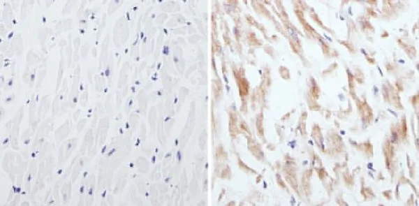 Immunohistochemistry (Formalin/PFA-fixed paraffin-embedded sections) - Anti-CPEB1 antibody (AB3465)