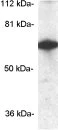 Western blot - Anti-CPEB1 antibody (AB3465)