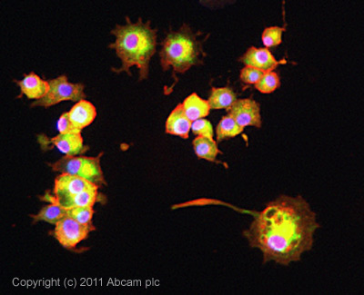 Immunocytochemistry/ Immunofluorescence - Anti-CPEB1 antibody (AB73287)