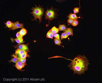 Immunocytochemistry/ Immunofluorescence - Anti-CPEB1 antibody (AB73287)