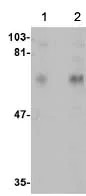 Western blot - Anti-CPEB1 antibody (AB73287)