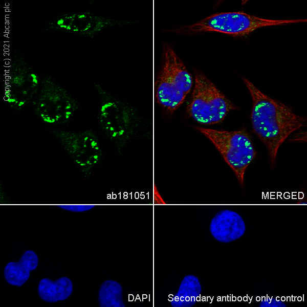 Immunocytochemistry/ Immunofluorescence - Anti-CPEB1 antibody [EPR11775(2)] (AB181051), expandable thumbnail