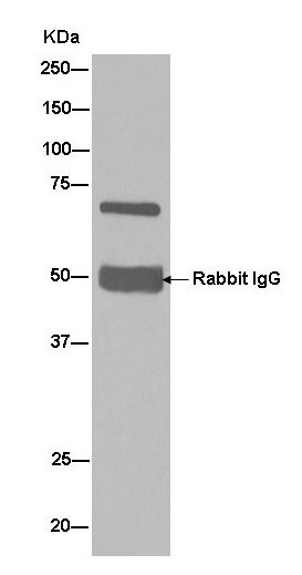 Immunoprecipitation - Anti-CPEB1 antibody [EPR11775(2)] (AB181051), expandable thumbnail